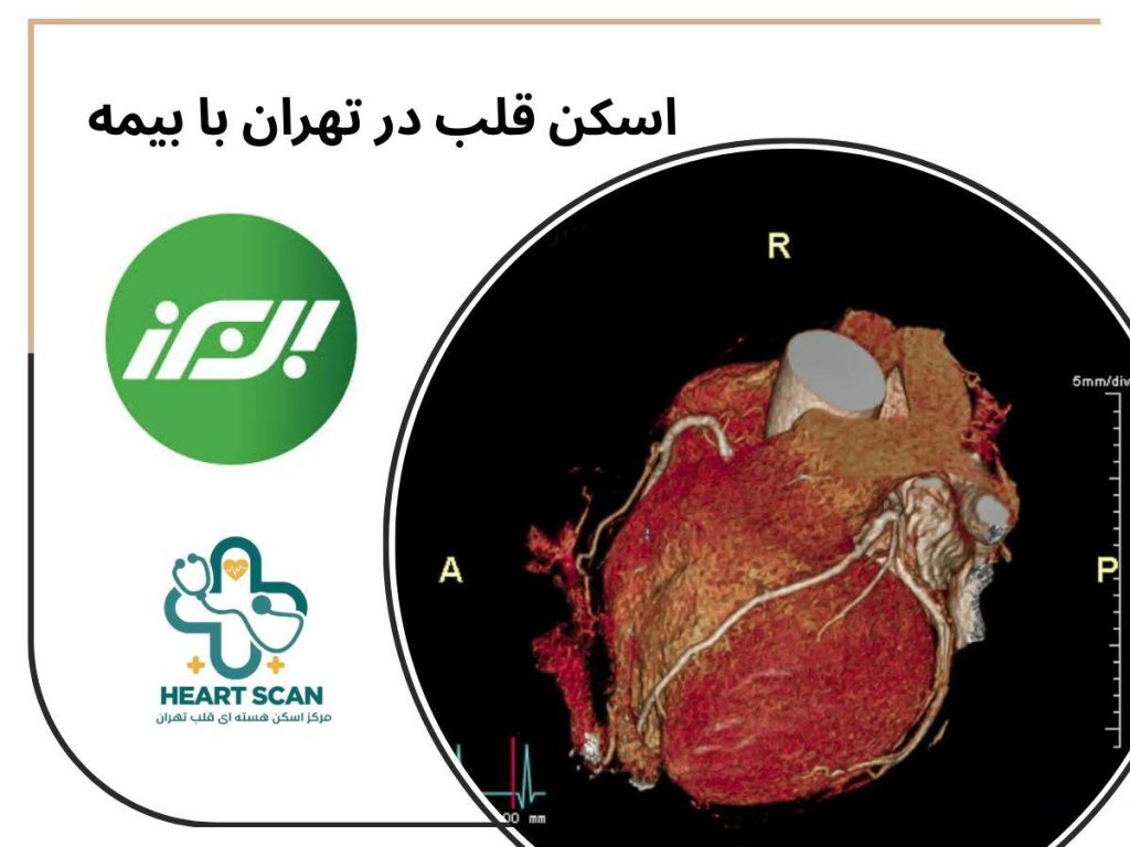 بیمه البرز برای اسکن قلب اسکن قلب در تهران با بیمه