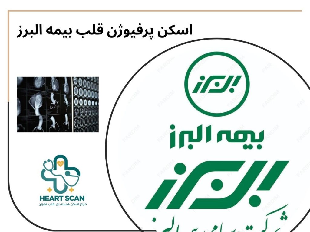اسکن پرفیوژن قلب بیمه البرز