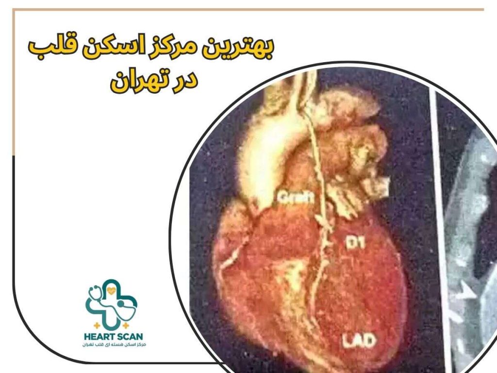بهترین مرکز اسکن قلب در تهران