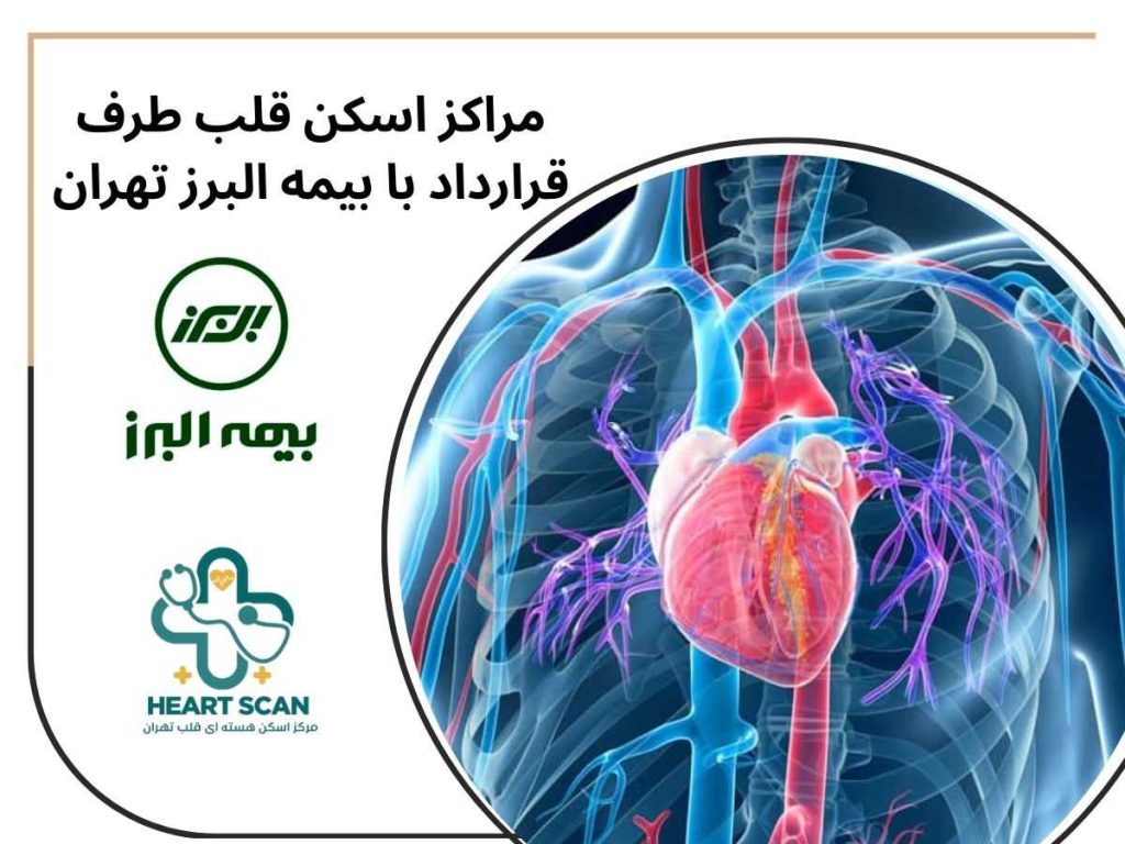مراکز اسکن قلب طرف قرارداد با بیمه البرز تهران